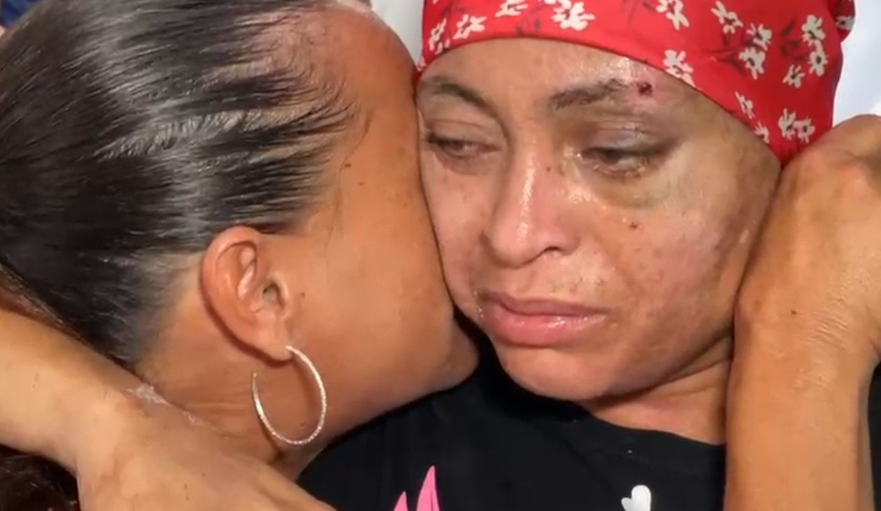 Mulher dada como morta por engano tem  alta hospitalar e precisará de fisioterapia para recuperar movimentos