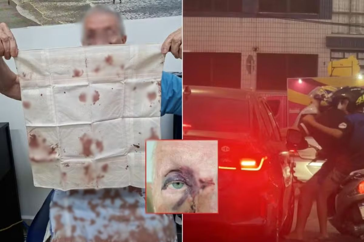 Idoso é atacado com socos e chutes de motociclistas após acidente de trânsito no litoral de SP; VÍDEO