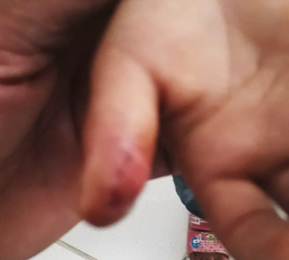 Cordas eram usadas para torturar a criança na cidade de Barra — Foto: Redes sociais