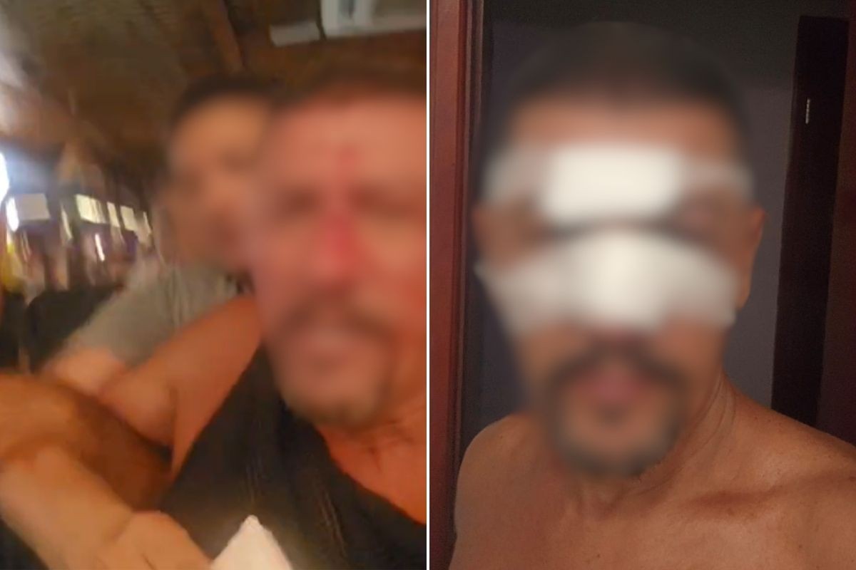 Empresário é agredido por segurança de quiosque após amigo perder a comanda: 'poderia ter morrido'; VÍDEO