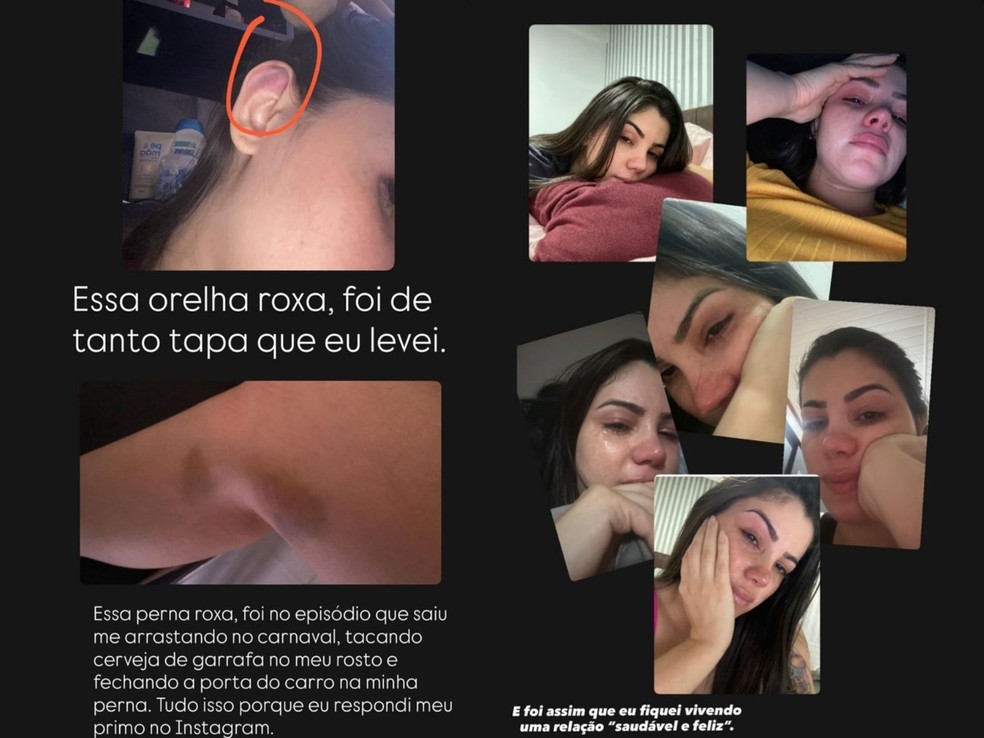 midia-de-distribuicao-g1-2026-03-02t115529.967 'Momento intenso e de acolhimento', diz ex-primeira-dama após denunciar prefeito por violência no Acre