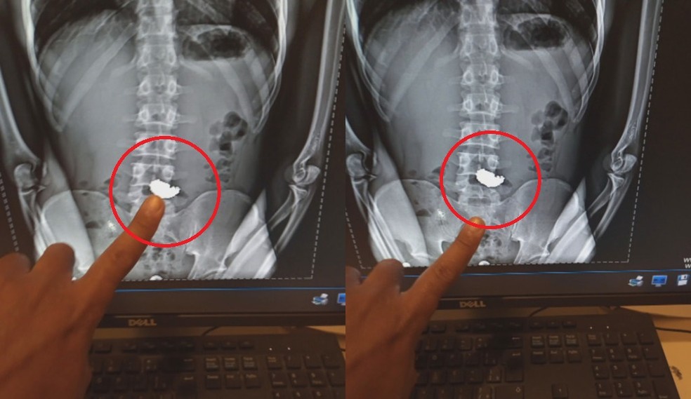 Raio-x mostra correntinha no estômago de ladrão que foi preso após furto  — Foto: Divulgação/GCM-BH