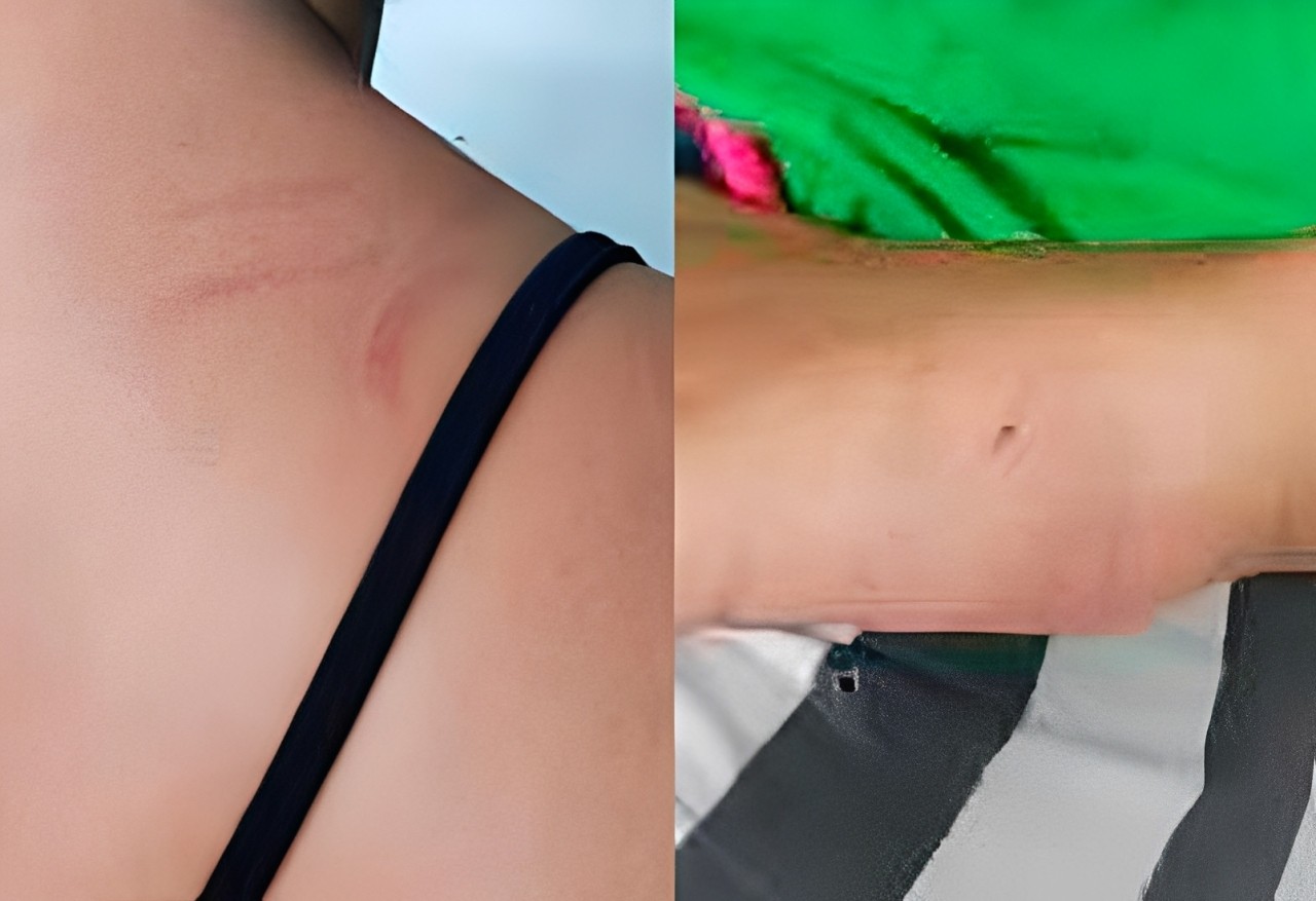 Café no rosto e vassouradas: briga entre vizinhas por causa de piercing mobiliza a polícia em MG