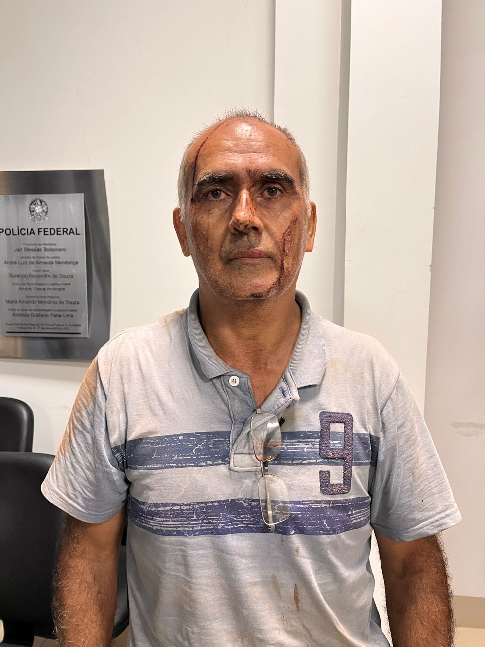 Donizete Veríssimo Dias tinha ferimentos no rosto por causa do pouso forçado — Foto: Reprodução