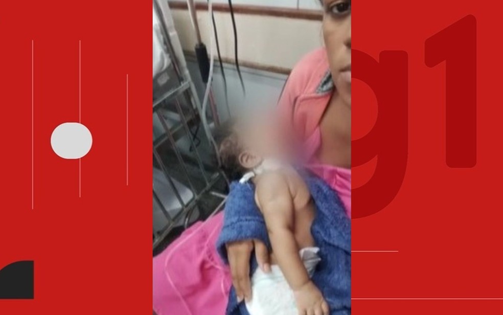 Bebê de 2 meses tem pé amputado após suspeita de infecção e família denuncia negligência de hospital — Foto: Reprodução/TV Bahia