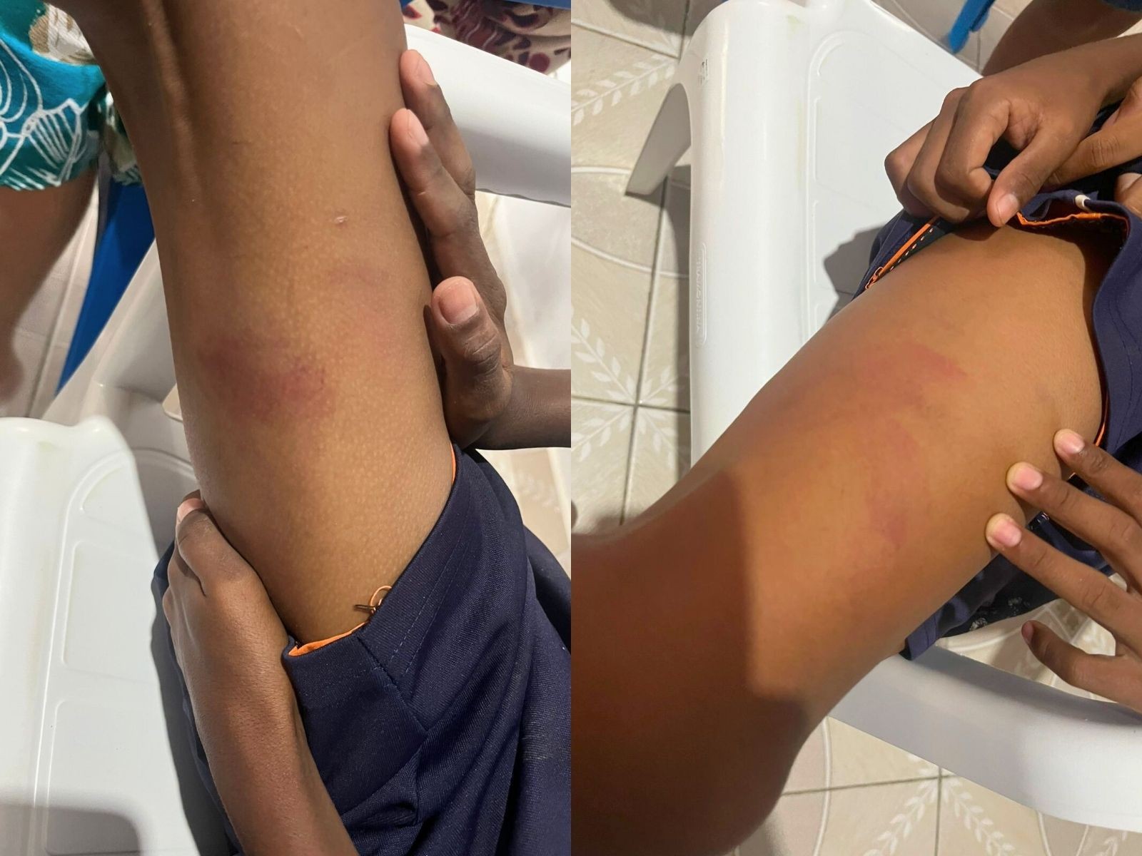 Pai é preso após agredir filho de 12 anos com cinto no AC: 'Tentou abafar os gritos com a mão'