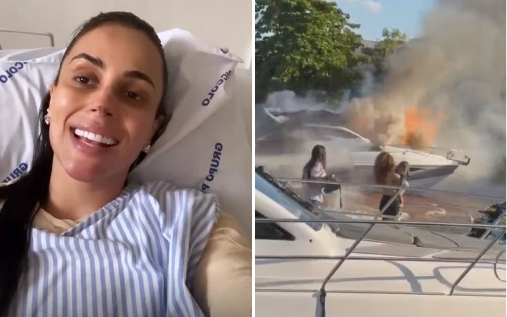 Médica que teve 50% do corpo queimado em explosão de lancha agradece nova chance: “O que importa é estar viva