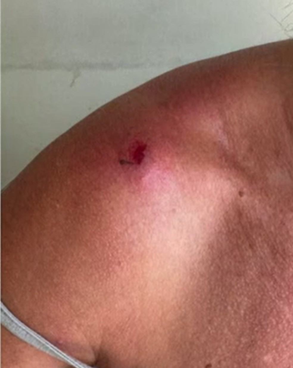 Mulher agredida no trânsito nesta quinta-feira (30) — Foto: Divulgação