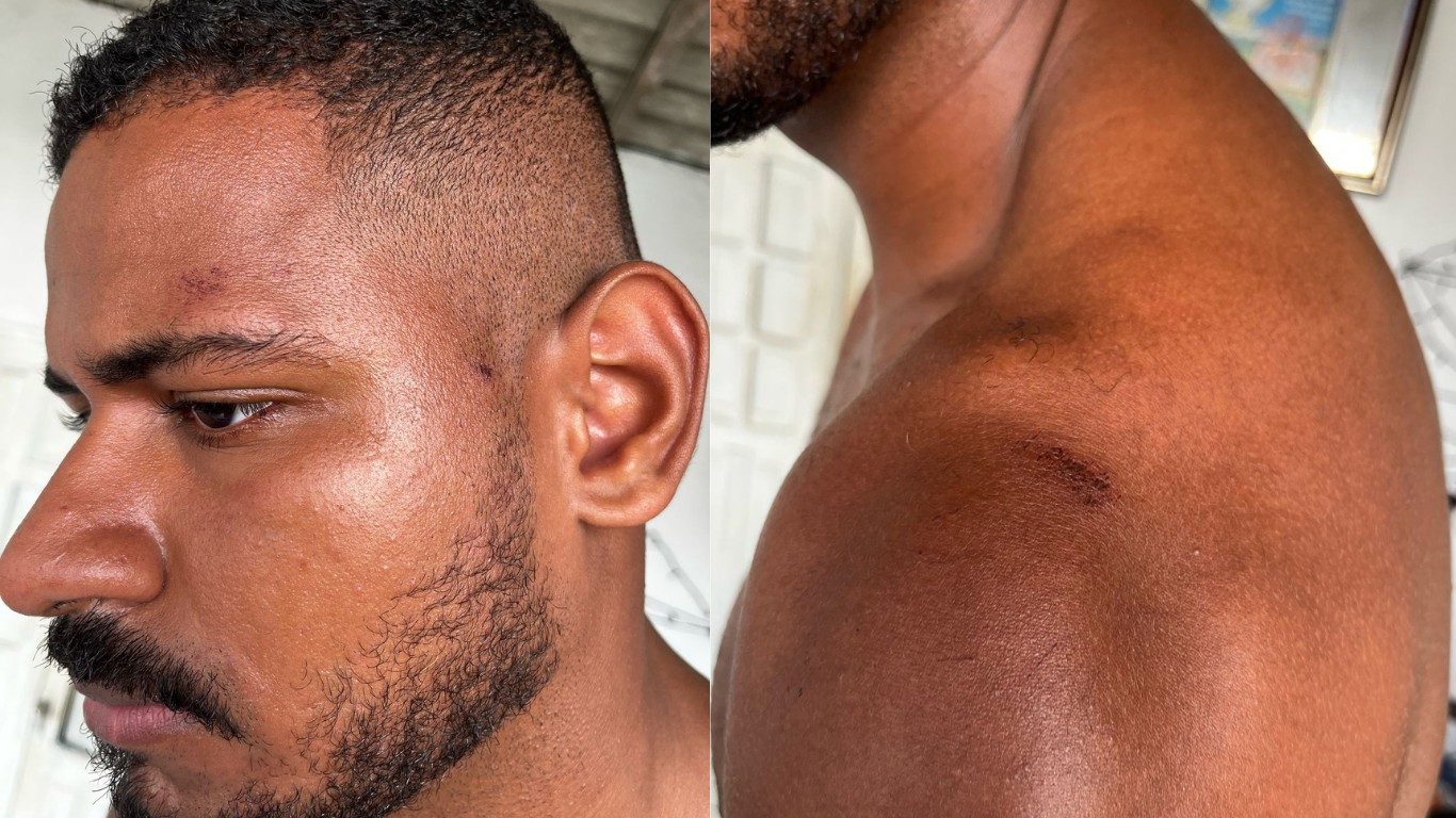 ‘Racismo’: Analista denuncia violência policial durante show no São João de Caruaru