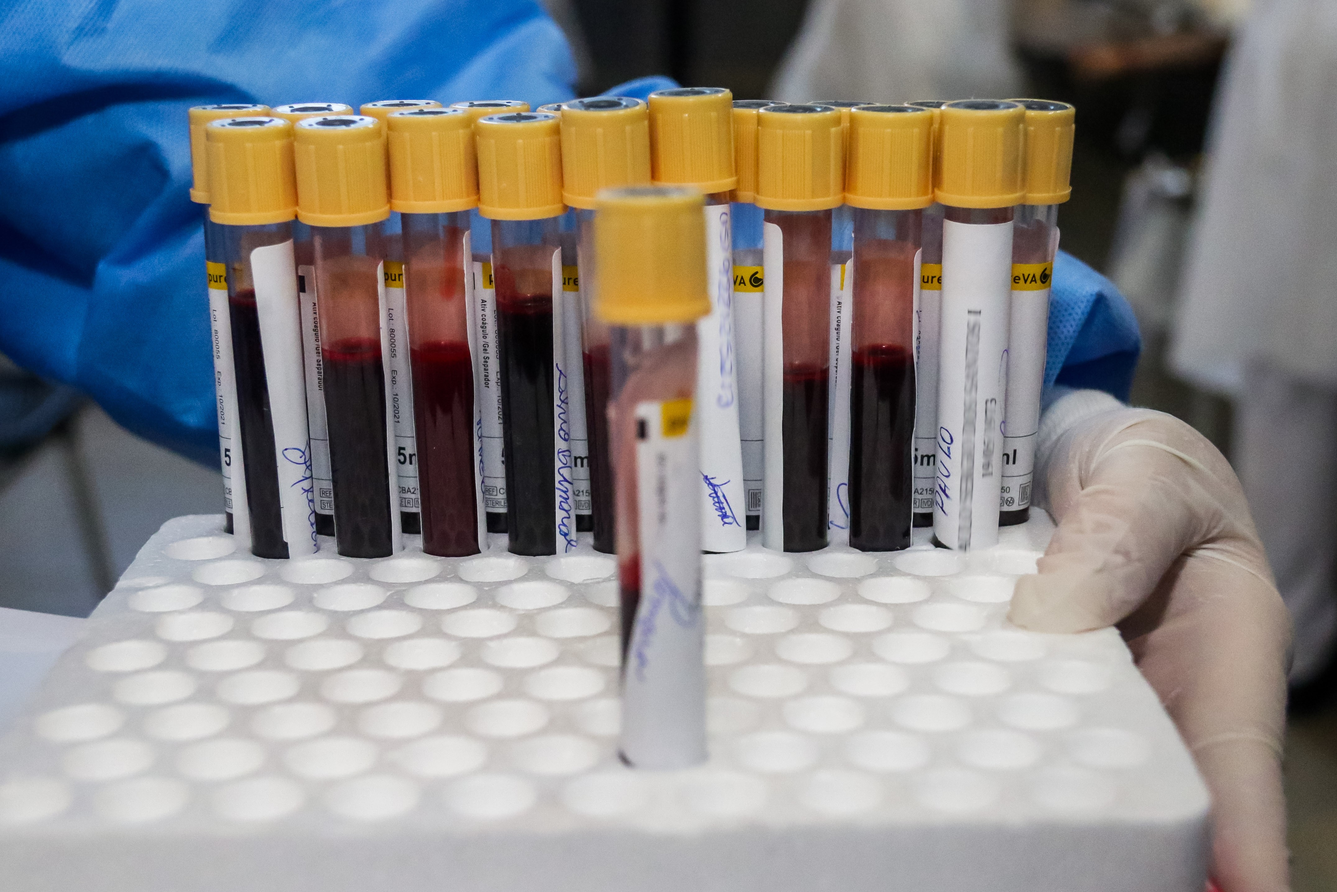 Centro universitário oferece exames laboratoriais de sangue, fezes e ...