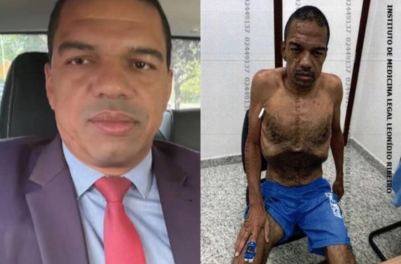 FOTOS: lobista investigado em esquema de vendas de decisões judiciais fica debilitado após 8 meses na prisão