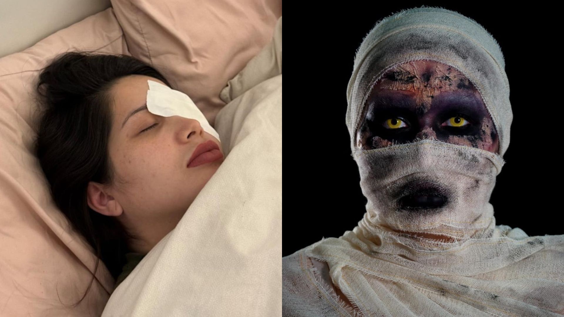 Influencer do AP sofre hemorragia ocular após usar lentes vencidas por acidente para 'trend' viral