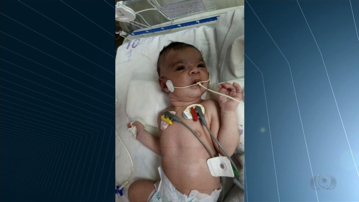 Pais cobram há um mês vaga de UTI para bebê que nasceu com malformação no coração, em Goiânia