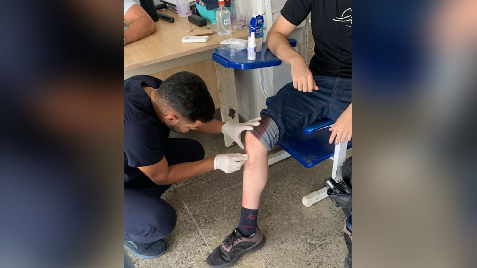 Estudante é esfaqueado durante tentativa de assalto próximo à universidade em Fortaleza