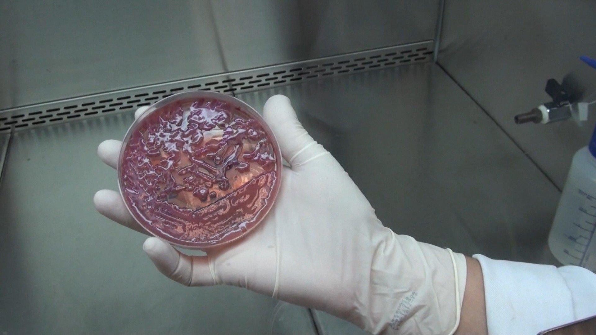 Hospital Estadual de Sumaré identifica superbactéria KPC em 14 pacientes internados