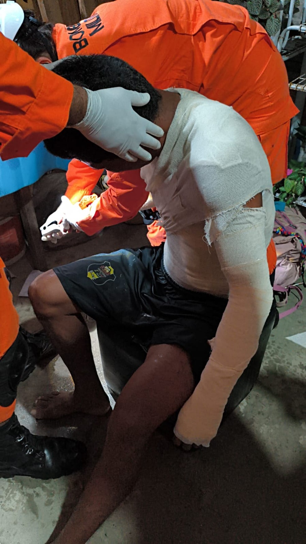 Homem tem 30% do corpo queimado após incêndio em casa na Zona Norte — Foto: Reprodução/Rede Amazônica