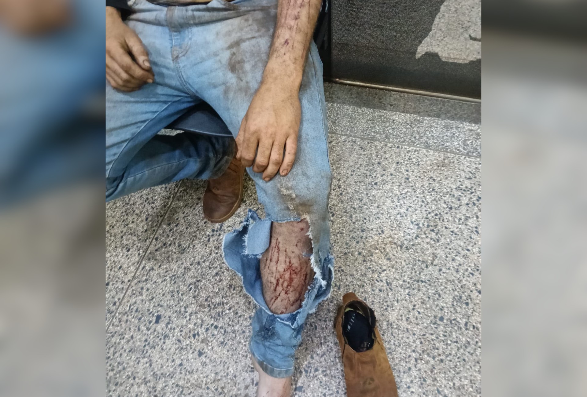 Jovem é socorrido após relatar ataque de possível onça durante trabalho em área rural de MS