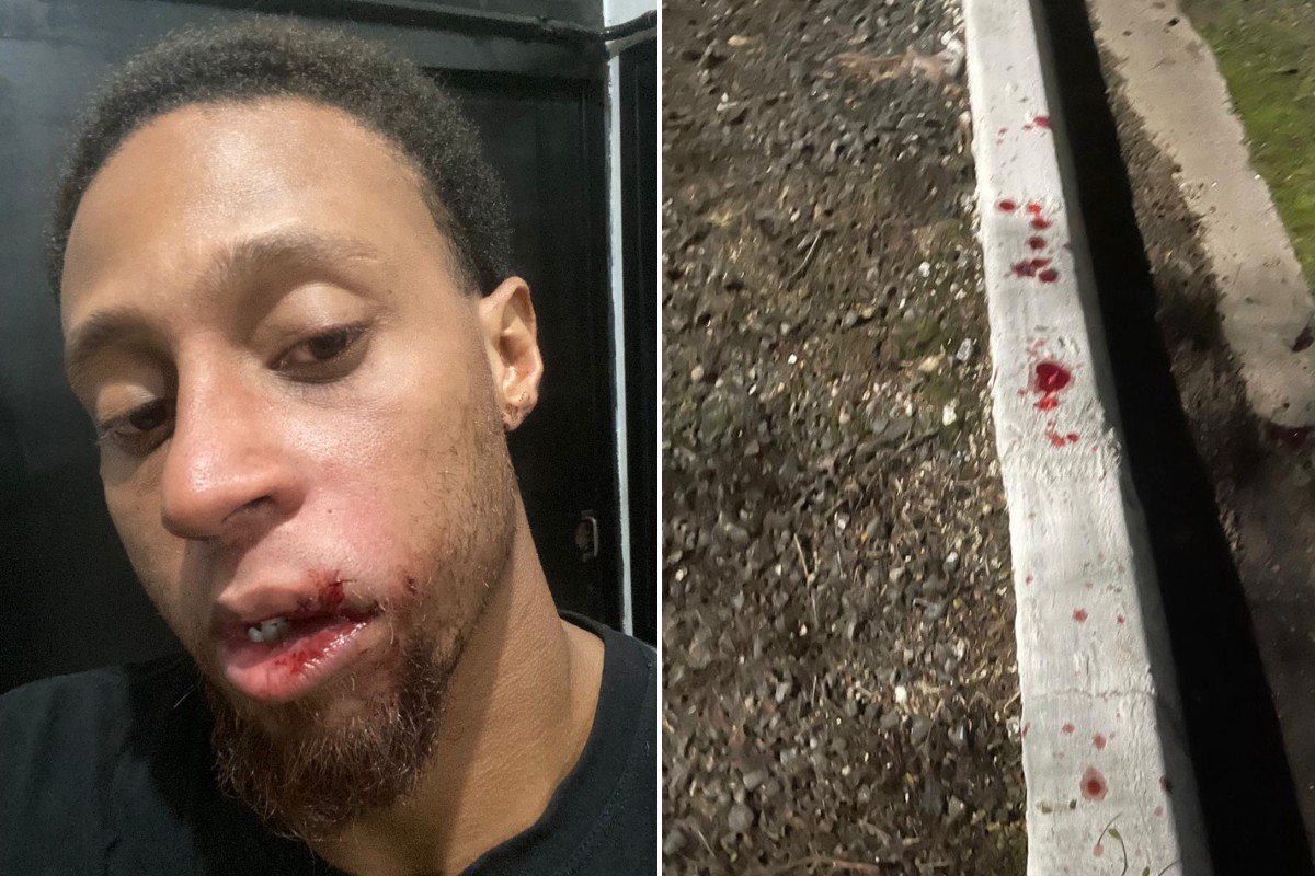 Filho de prefeito é agredido a socos por seguranças ao tentar retornar à pagode no interior de SP; VÍDEO