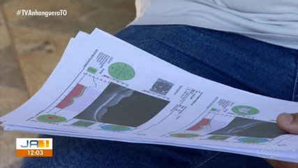Com demora no atendimento pelo SUS, pacientes recorrem a cirurgias particulares