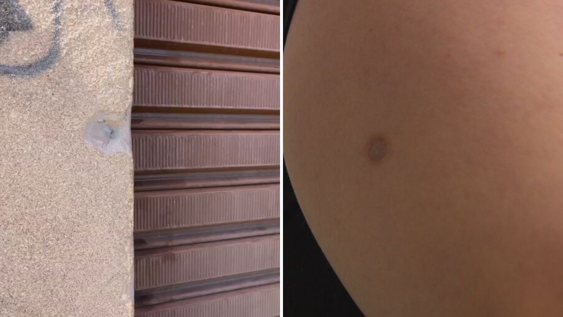 Troca de tiros entre gangues rivais deixou inocente sem movimento das pernas ao ser baleado: 'Aprende a viver de novo'