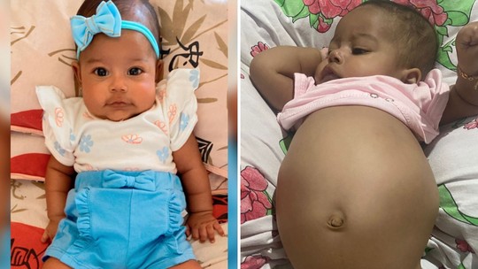 Bebê goiana de 4 meses com suspeita de tumor na barriga luta por tratamento na rede pública - Foto: (Acervo pessoal/Cleidielle Rodrigues de Sousa)