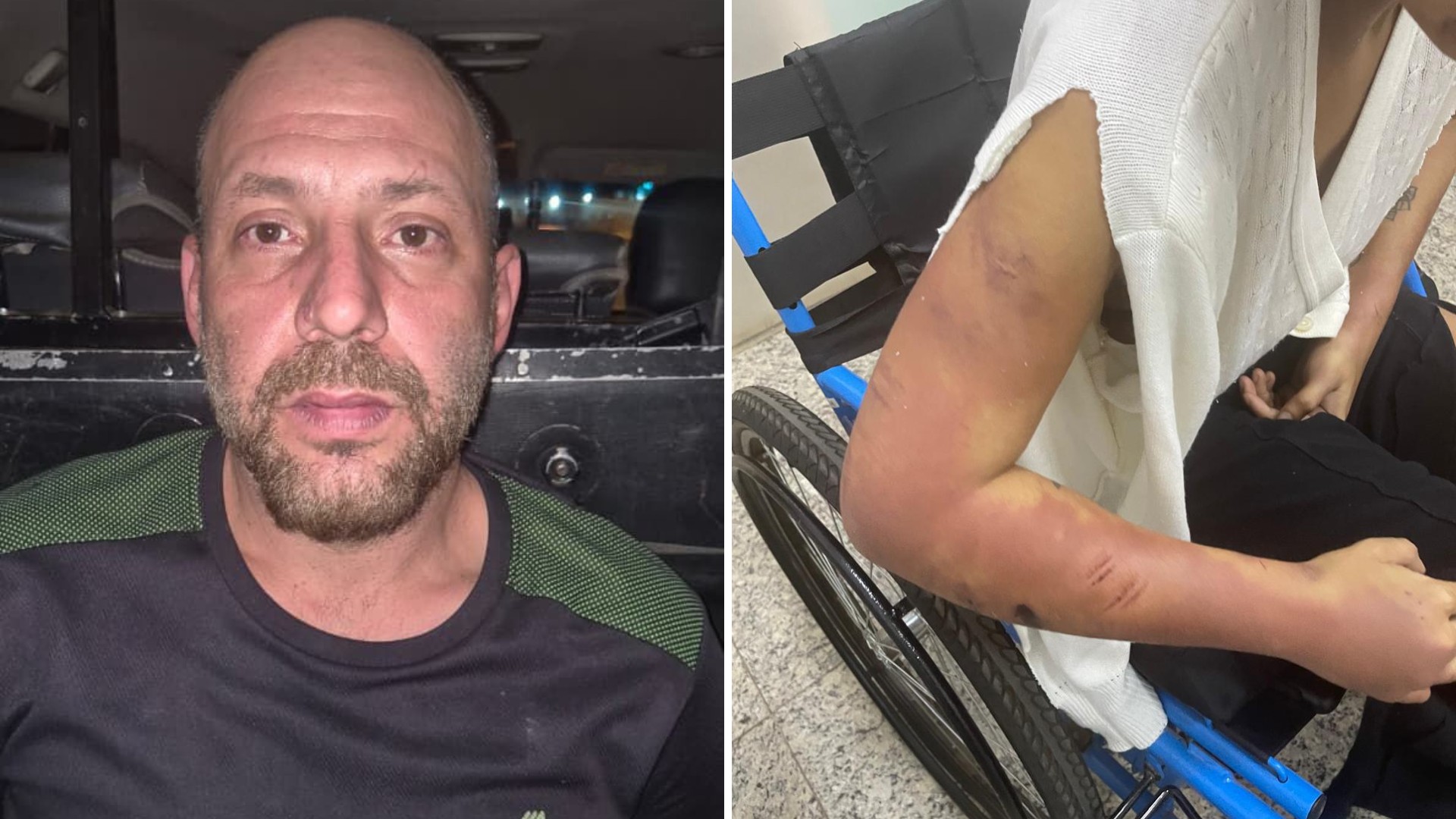 Mulher sequestrada, torturada e mantida em cárcere durante 4 dias já tinha sido agredida e acreditou que namorado iria mudar, diz delegado
