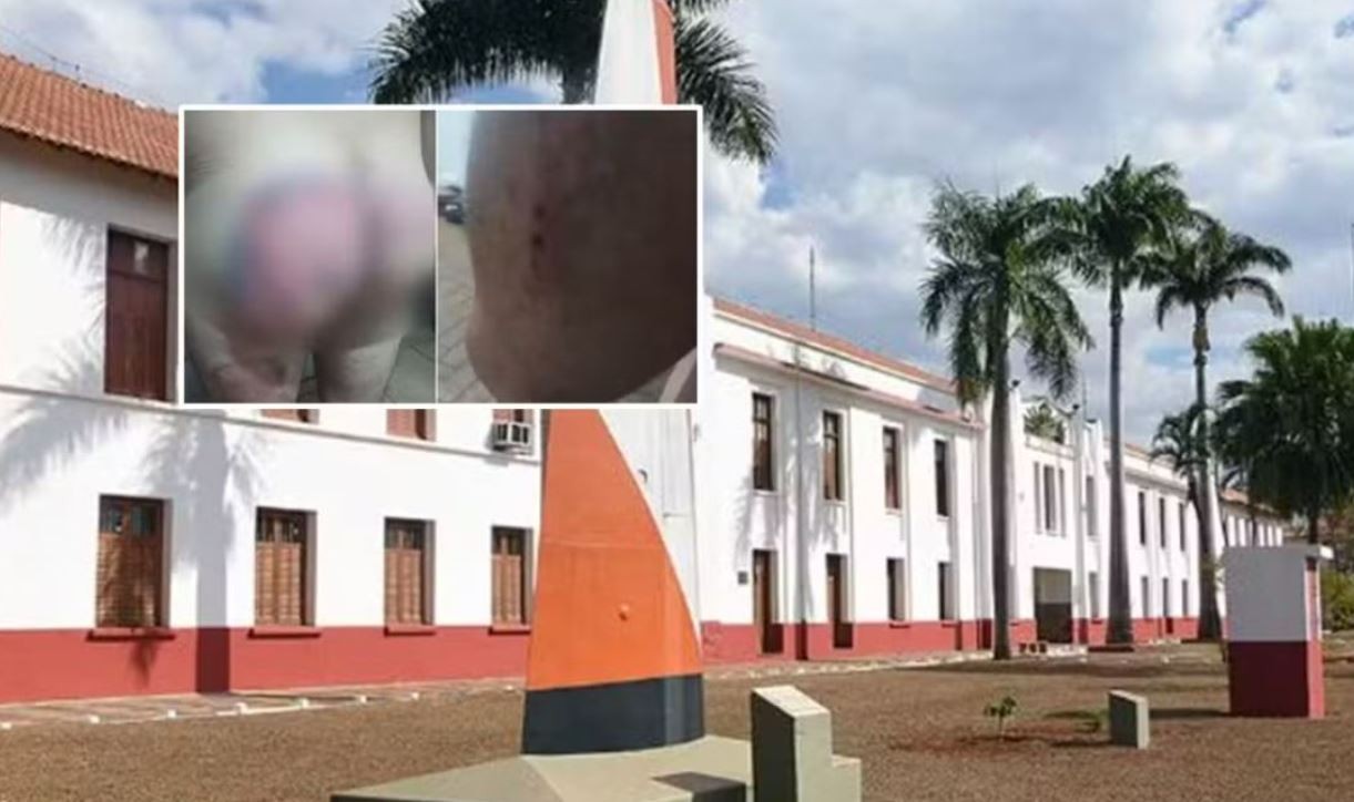 Sem condições de saúde, soldado que denunciou agressão em quartel é afastado por tempo indeterminado do Exército 