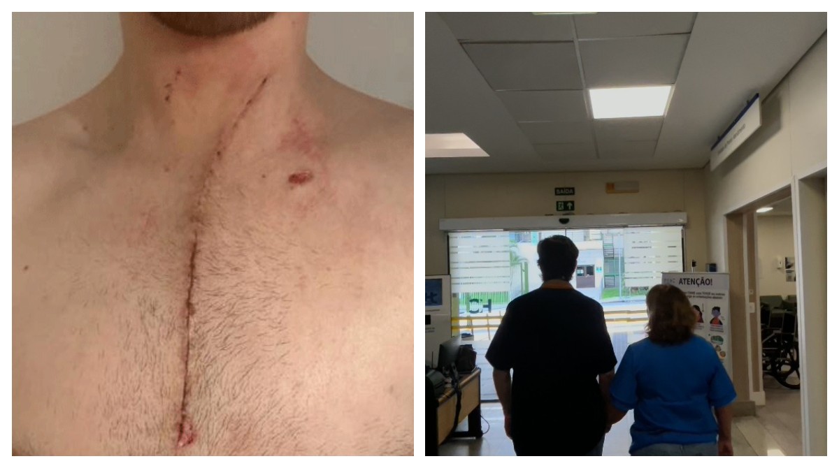 VÍDEO: médico que teve pulmão perfurado ao ser esfaqueado após blocos perto do metrô Higienópolis deixa hospital em SP