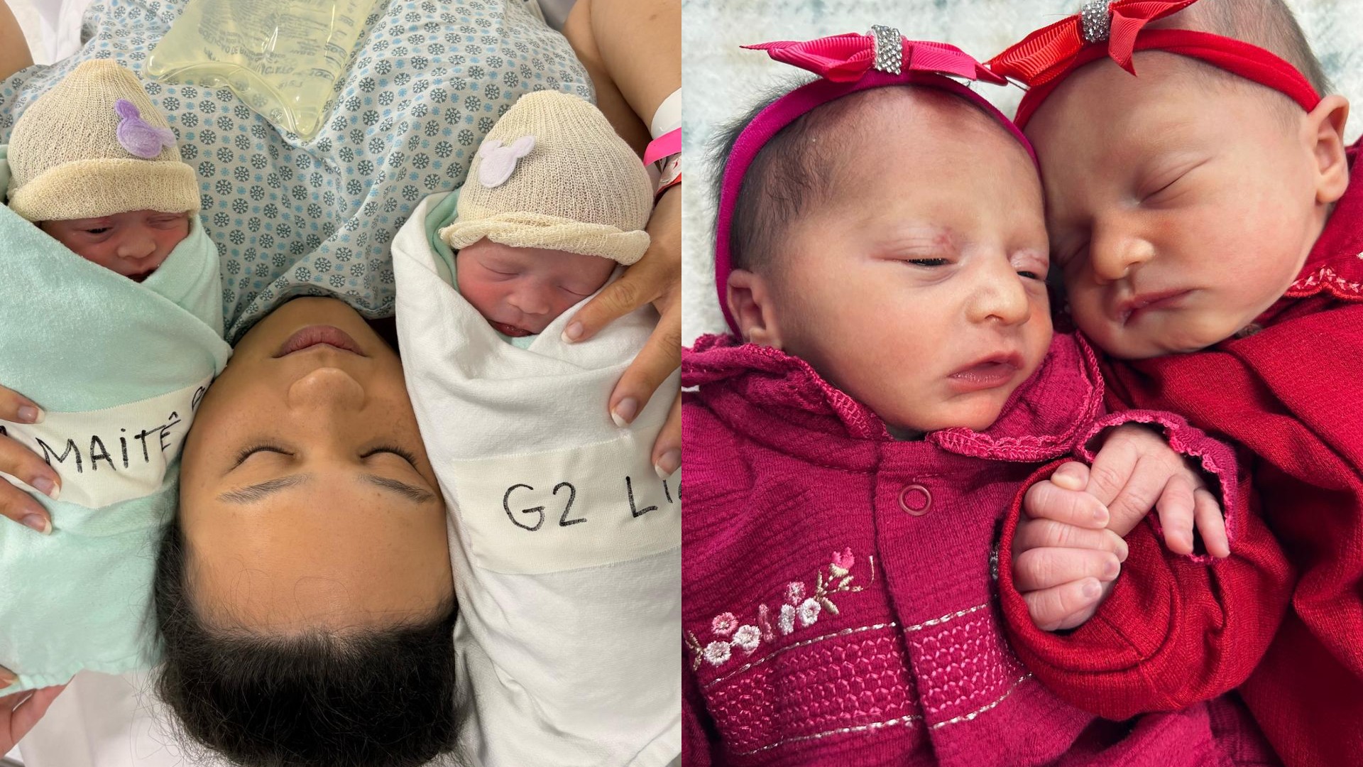 VÍDEO: mulher dá à luz gêmeas em parto empelicado no interior de SP