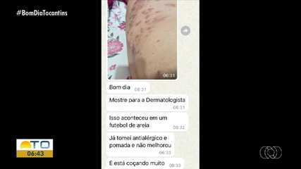 Telespectadores tiram dúvidas sobre doenças infecciosas e parasitárias no Bom Dia Responde