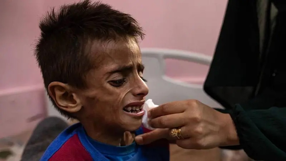 Osama al-Raqab, de 5 anos, recebendo tratamento no Hospital Nasser de Khan Younis, no sul da Faixa de Gaza — Foto: EPA via BBC